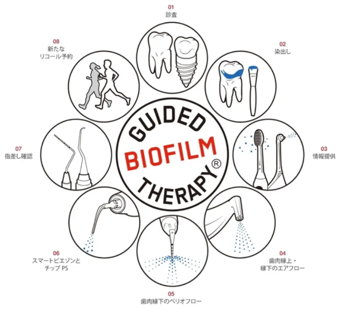 診療案内-歯周病治療-GBTプロトコールの8ステップ